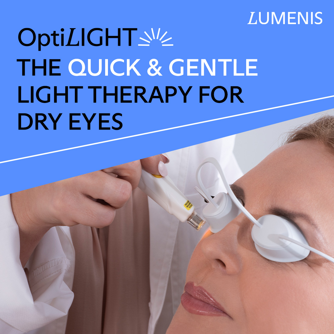 OptiLight IPL dry eye treatment in Saratoga Springs, NY